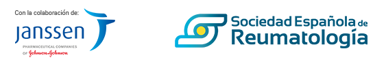 ser